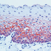      E  / Cadherin E / E-Cadherin Ab-3