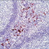      / Macrophage / L1 Protein / Calprotectin Ab-1