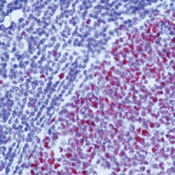     MSH2 / MSH2 (Mismatch Repair Protein 2) Ab-1