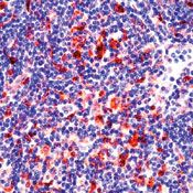     -3 / Galectin-3 Ab-1