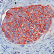        / Ep-CAM  / Epithelial Specific Antigen / Ep-CAM Ab-3