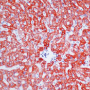      / Hepatocyte Ab-1
