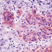        / Ep-CAM  / Epithelial Specific Antigen / Ep-CAM Ab-7