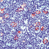     CD30 / CD30 (Reed-Sternberg Cell Marker) Ab-4  
