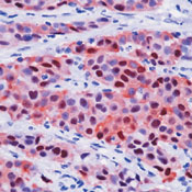      / Calretinin Ab-2