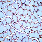      / Dysferlin Ab-1