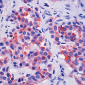      5 / Keratin 5 Ab-1