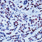       / Progesterone Receptor Ab-2