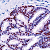       / Progesterone Receptor Ab-7