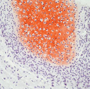      II / Collagen II Ab-2