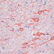      MAP 2a,b / MAP 2a,b (Microtubule-Associated Protein) Ab-2