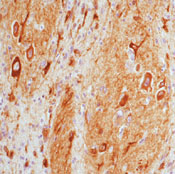     MAP / MAP 2a,b,c (Microtubule-Associated Protein) Ab-3 