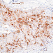       / Laminin Receptor Ab-1