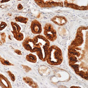         / Prostate Specific Antigen (PSA) Ab-1  