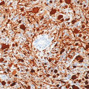         (GFAP) / GFAP / Glial Fibrillary Acidic Protein Ab-1  