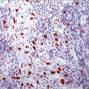     CD117 / c-Kit / SCF-Receptor  / CD117 / c-Kit / SCF-Receptor Ab-2 sample