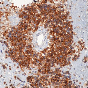     CD99/MIC2 (  ) / CD99 / MIC2 (Ewing’s Sarcoma Marker) Ab-1