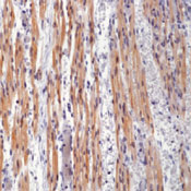      / Troponin T, Cardiac Isoform Ab-1