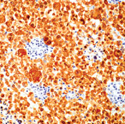     S100  / S100 Protein Ab-1  
