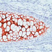      II  / Collagen II Ab-3