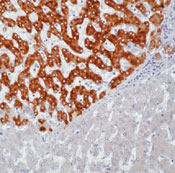         / Hepatitis B Virus Surface Antigen (HBVsAg) Ab-1  