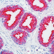          / Prostate Specific Acid Phosphatase (PSAP) Ab-1