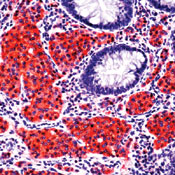      -  / Neuron Specific Enolase / NSE Ab-1  