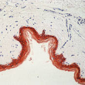       / Keratin, HMW Ab-1