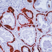         / Keratin, HMW Ab-2