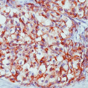        / Epithelial Membrane Antigen / EMA  Ab-2