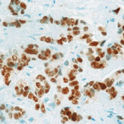       / Estrogen Receptor Ab-11