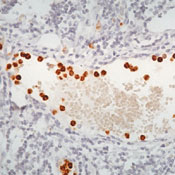       / Myeloperoxidase (MPO) Ab-1  