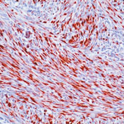      (  ) / Desmin (Muscle Cell Marker) Ab-1