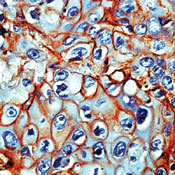         / Epidermal Growth Factor Receptor / EGFR Ab-10