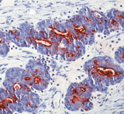     CA19-9 / CA19-9 / Sialyl Lewis^a^ (GI Tumor Marker) Ab-1