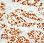        / Estrogen Receptor Ab-12