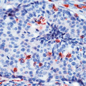       / Cathepsin D Ab-1