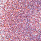        / CD45 / T200 / LCA Ab-3 (Cocktail, PAN-LCA)