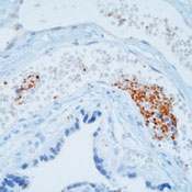      (TSP)  / Thrombospondin (TSP) Ab-4