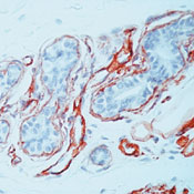      VII  / Collagen IV Ab-2