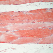       / Myoglobin Ab-1 sample