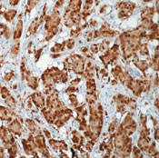        70 (HSP70) / Heat Shock Protein 70 (HSP70) Ab-2