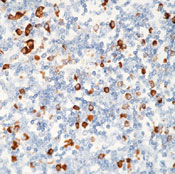       / Plasma Cell Ab-1