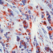       / Thymidine Phosphorylase / PD-ECGF Ab-1