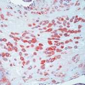        MMP-2 (72kDa  IV)  / MMP-2 (72kDa Collagenase IV) Ab-1