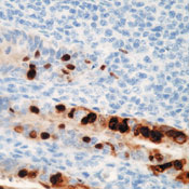       2 E1A  / Adenovirus Type 2 E1A Ab-2