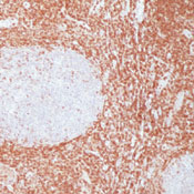     BCL-2alpha  / BCL-2alpha Ab-3