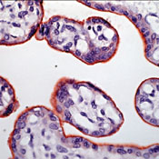       / Insulin Receptor (Alpha-Subunit) Ab-2