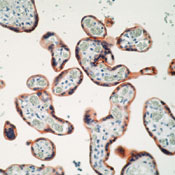       ( -)  / Insulin Receptor (Beta-Subunit) Ab-6