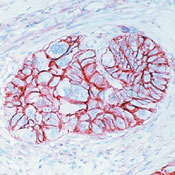     CD44/HCAM / CD44 Std. / HCAM Ab-4